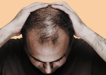 효과적이고 저렴한 탈모 솔루션 한국 최고의 탈모 억제제를 만나보세요